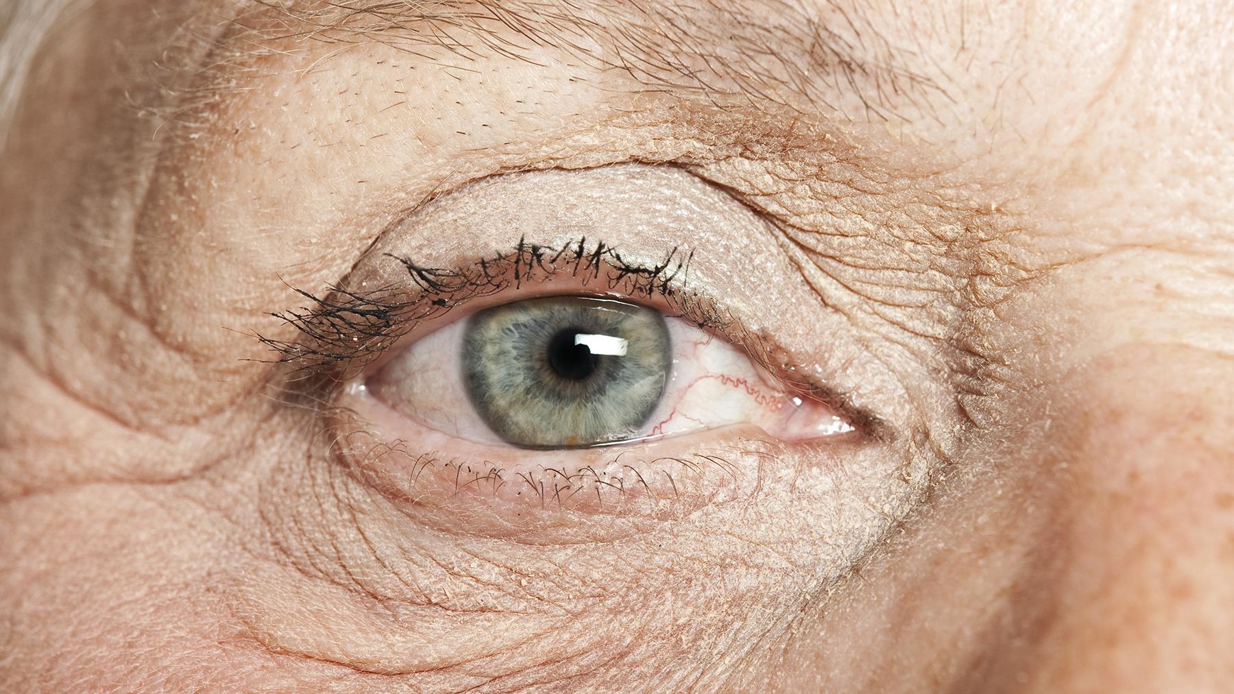 Lähikuva ikääntyneen naisen silmästä.
