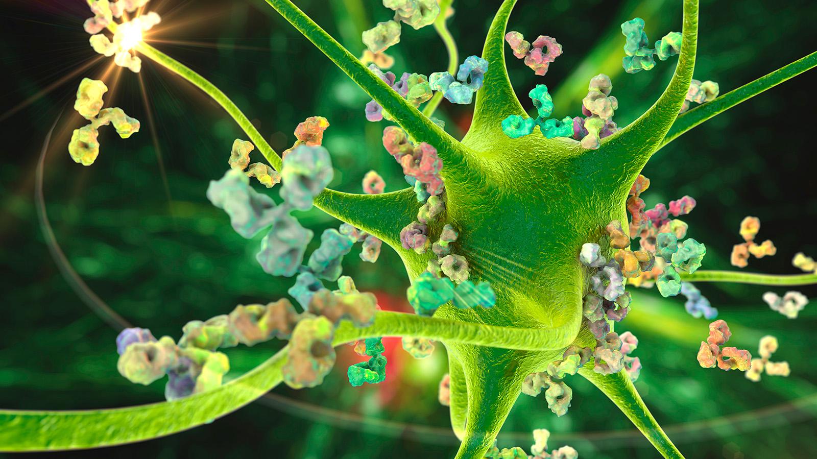 Vihreä monihaarainen hermosolu, jonka pinnassa ja ympärillä on värikkäitä nystyröitä.
